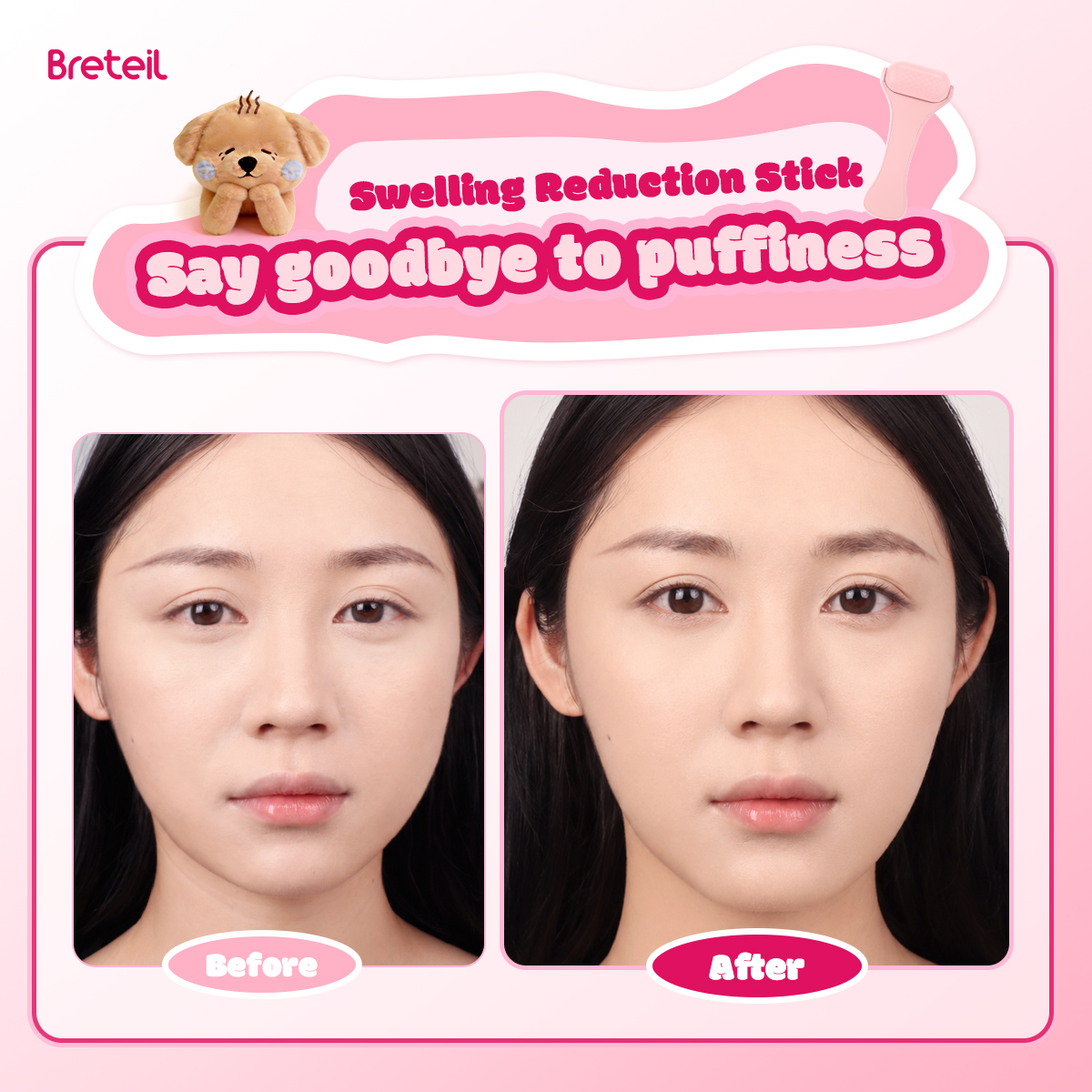 Breteil Wholesale Skincare Ice Therapy Device Facial Soothing Lifting Anti-Wrinkle Cold Therapy Ice Stick Facial Massage Roller - 图片 7