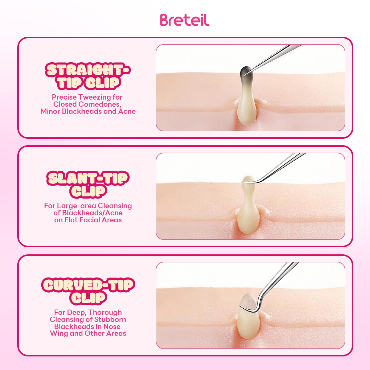 Breteil 3-Piece Ultra-fine Cell Pimples Blackhead Clip Tweezers Beauty Salon Special Scraping Artifact Acne Needle Tool - 图片 2