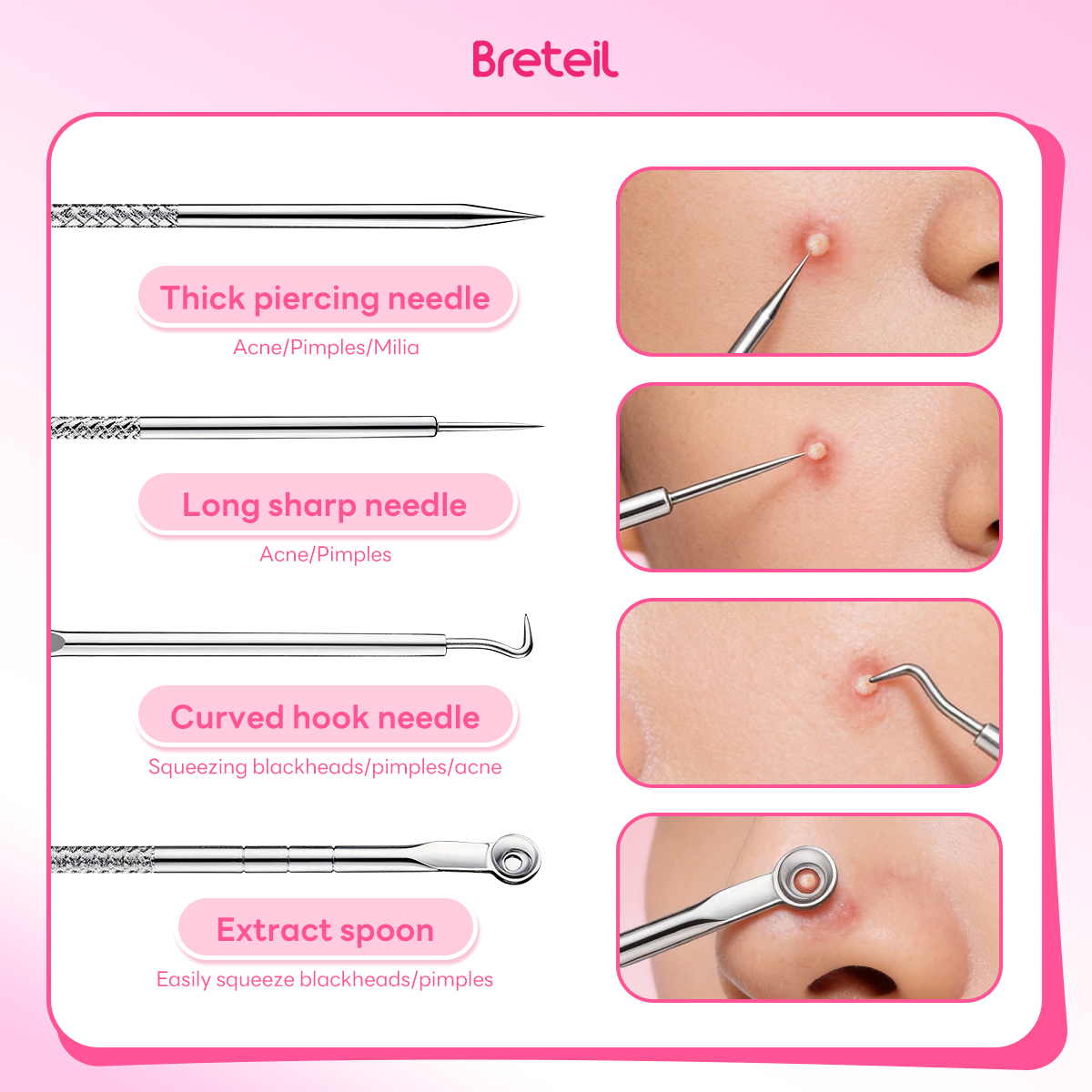 Breteil Wholesale  4-Piece Stainless Steel Facial Acne & Blackhead Removal Kit Wholesale 4pcs Acne Extraction Tools Case - 图片 2