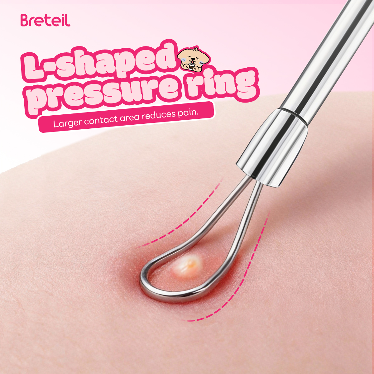 Breteil Wholesale  4-Piece Stainless Steel Facial Acne & Blackhead Removal Kit Wholesale 4pcs Acne Extraction Tools Case - 图片 3