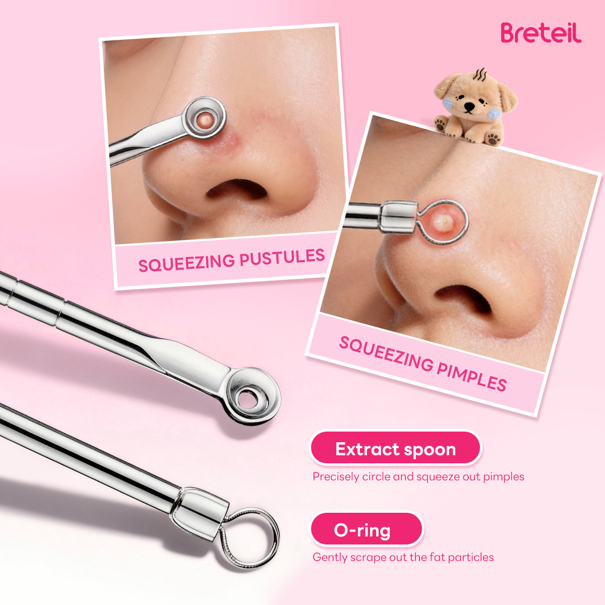 Breteil Wholesale  4-Piece Stainless Steel Facial Acne & Blackhead Removal Kit Wholesale 4pcs Acne Extraction Tools Case - 图片 6