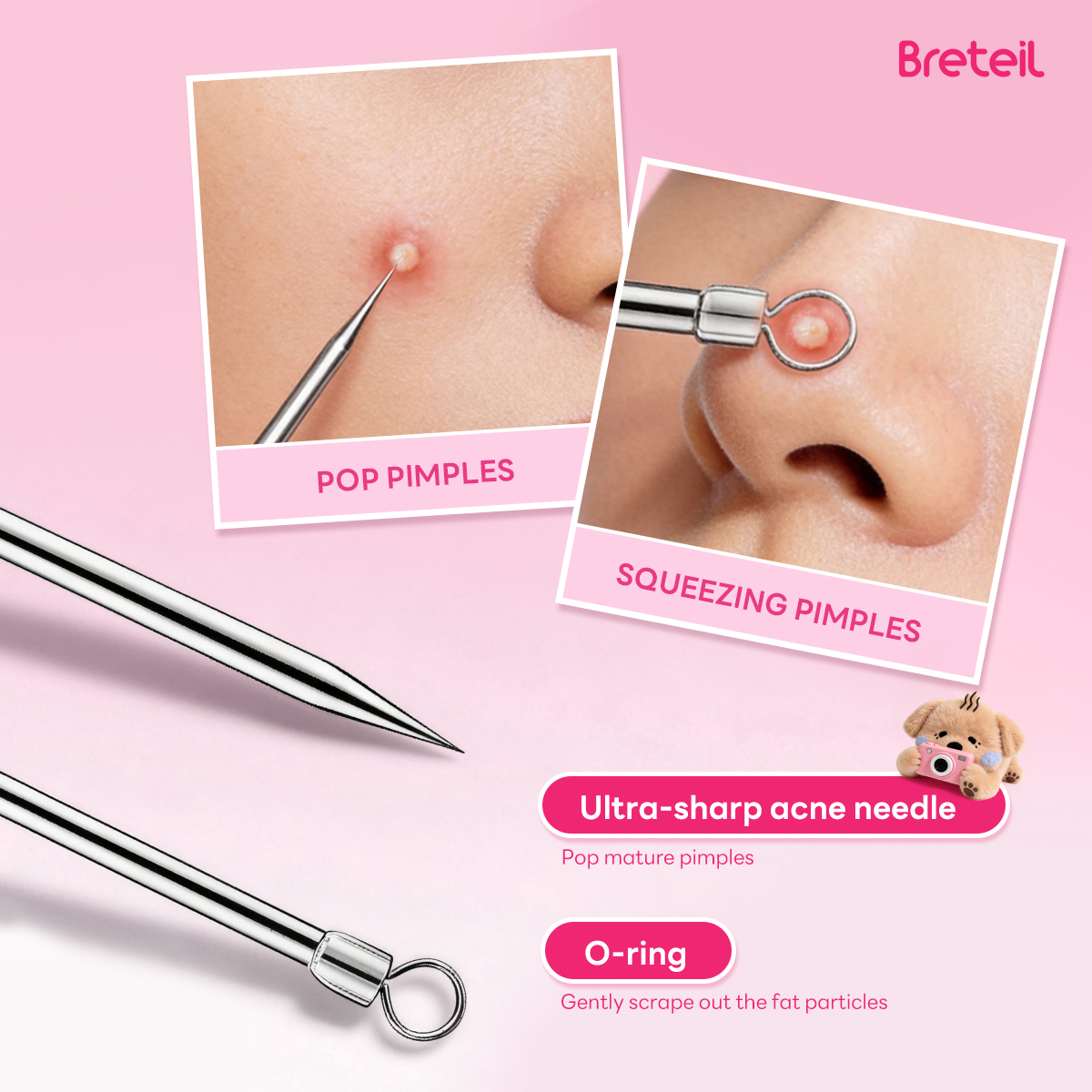 Breteil Wholesale  4-Piece Stainless Steel Facial Acne & Blackhead Removal Kit Wholesale 4pcs Acne Extraction Tools Case - 图片 8